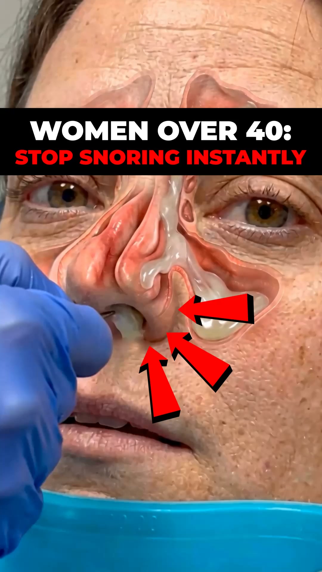 The Snoring Fix Made for Women