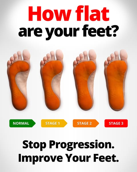 Pain-Free Feet in 60 Minutes