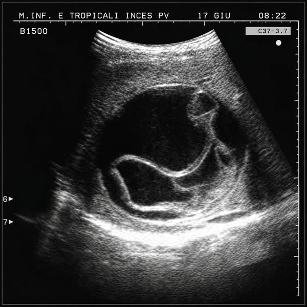 Depura il Tuo Corpo in 2 Fasi, in Modo Naturale