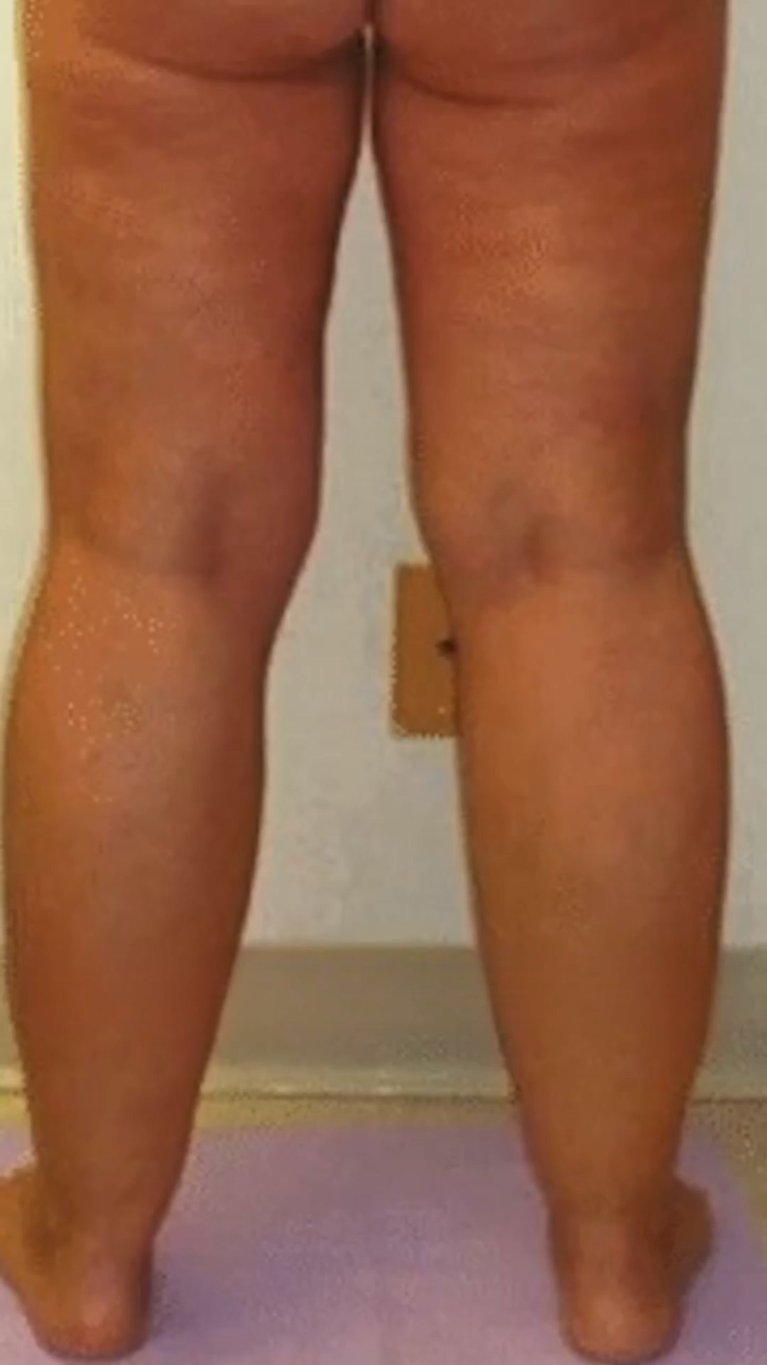 Les douleurs aux jambes et aux pieds, c’est du passé !
