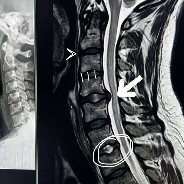 Neck pain? This could be the real reason