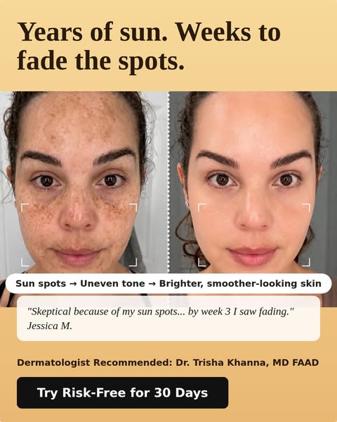 Finally-Skin You're Proud to Show