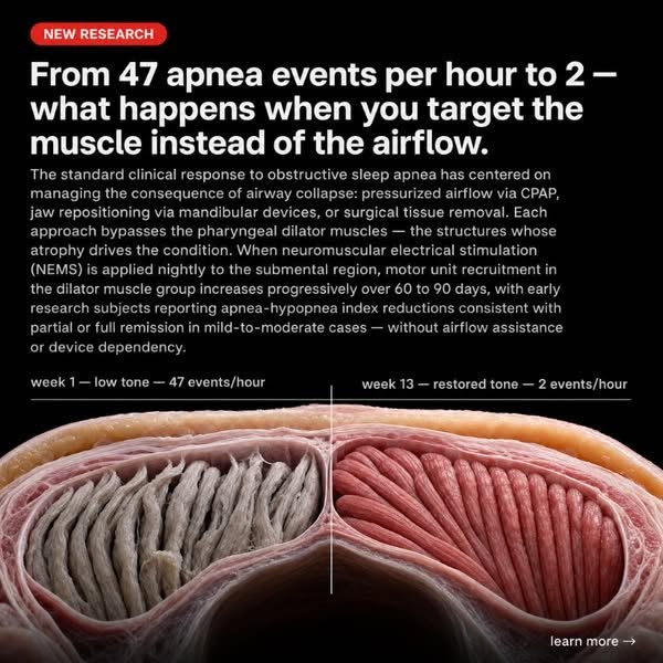 From 72 apnea events to zero. Simple