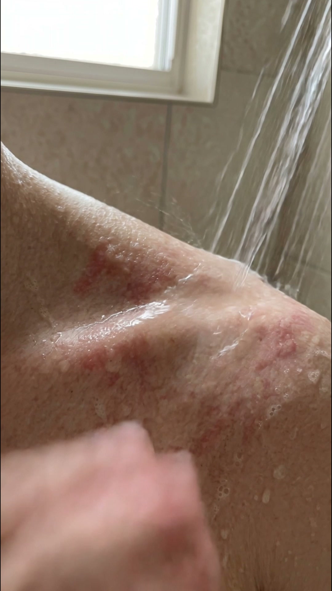 4.9/5 Descubre el efecto Natulim Kēr