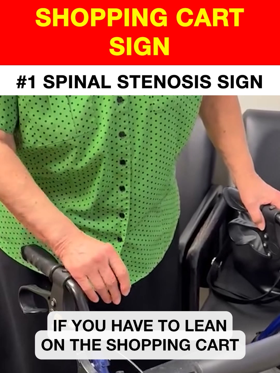 The Shopping Cart Sign That Points To Spinal Stenosis
