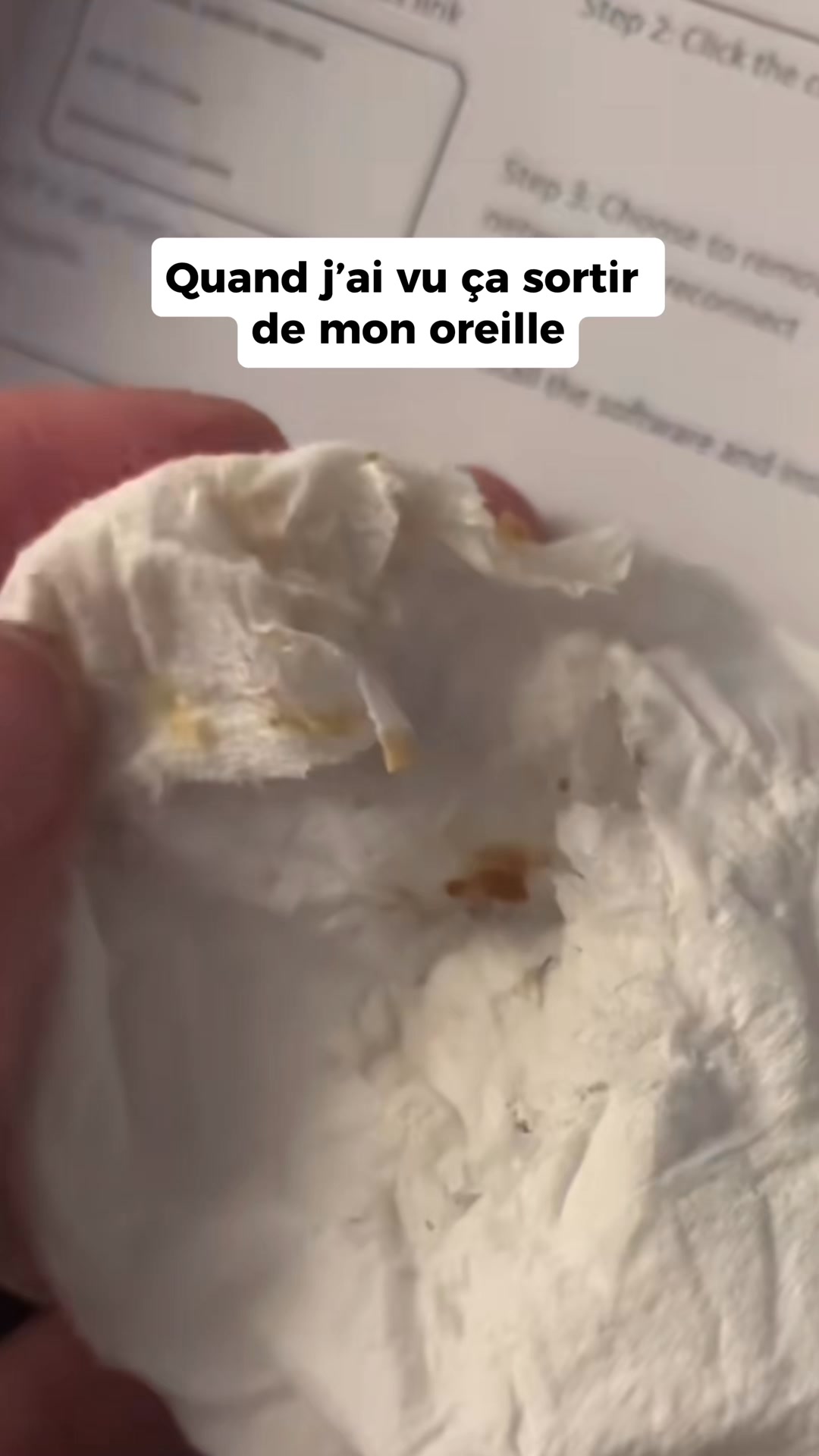 La solution validée techniquement par les ORL