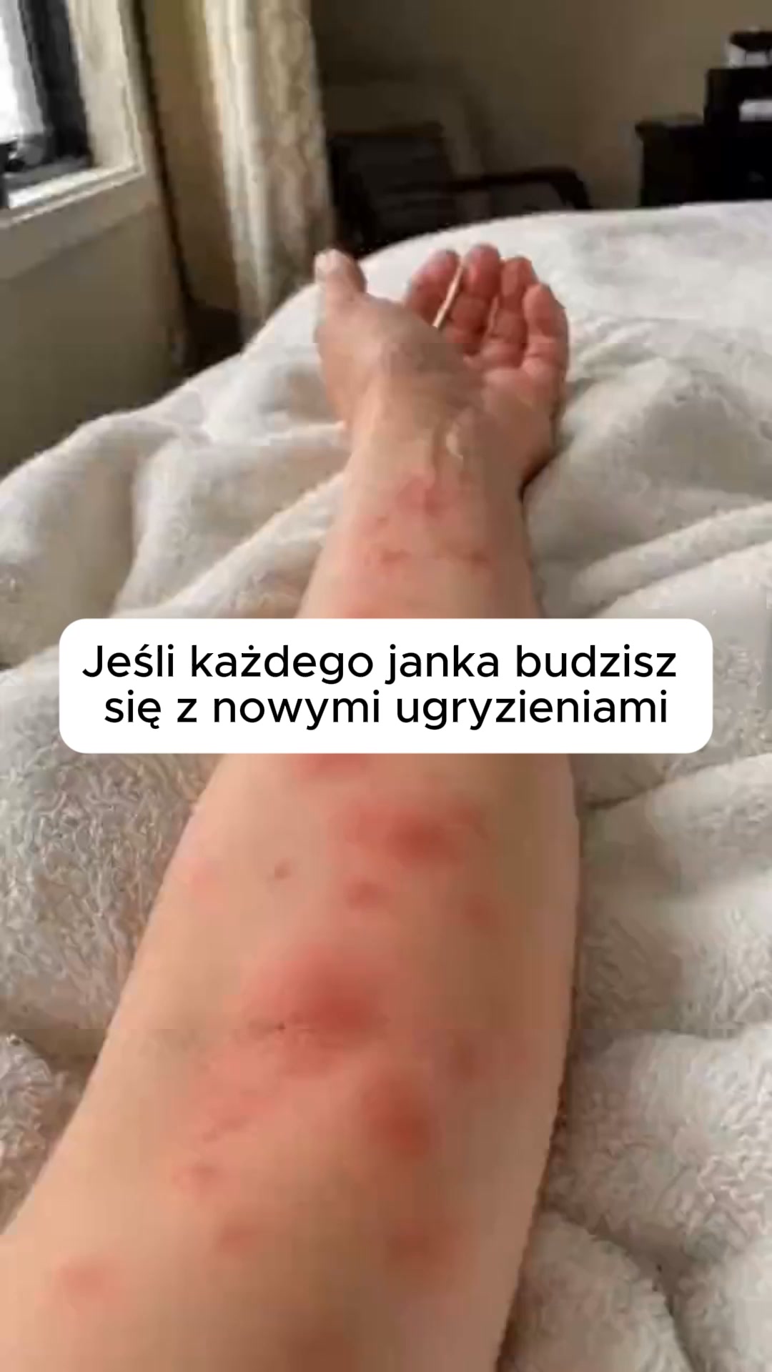 Koniec z ugryzieniami. Bez chemii.