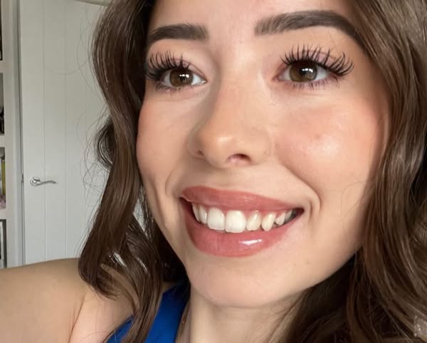 She Hasn't Been To The Dentist In 8 Months.