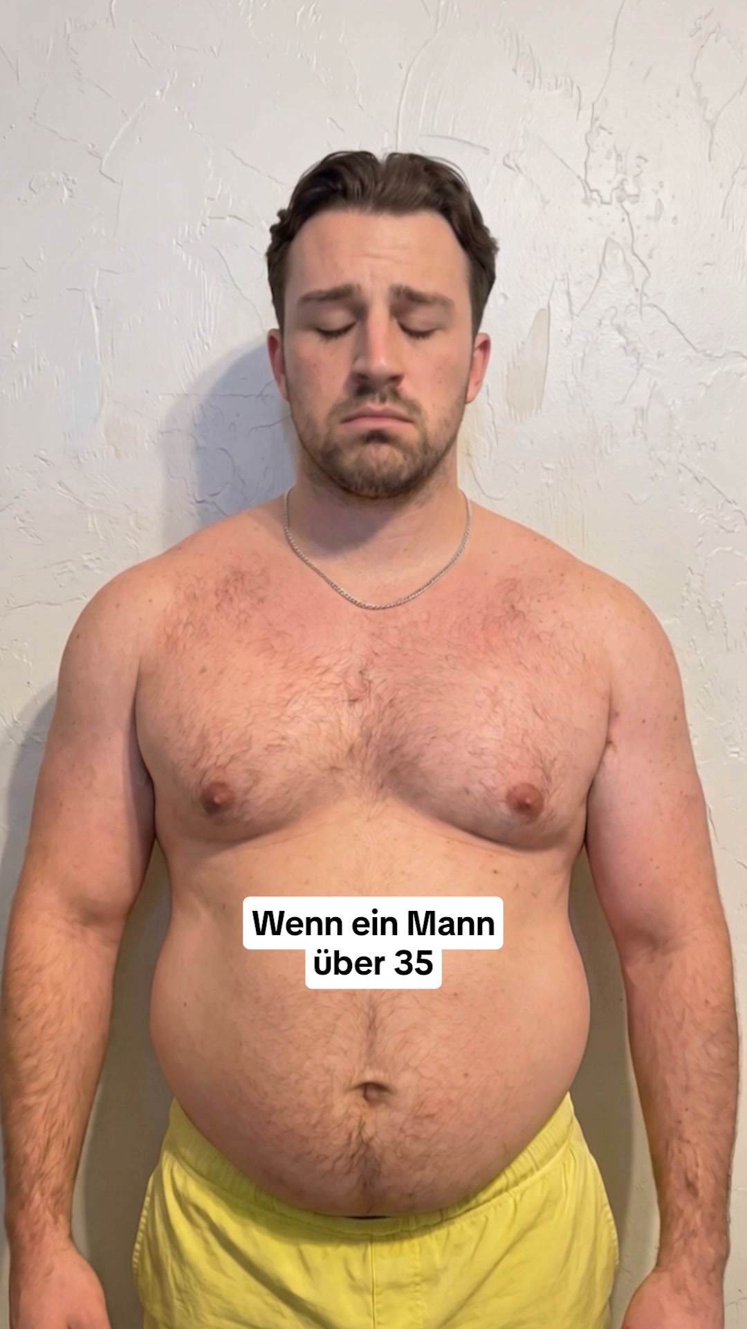 Fester Blähbauch, Hüfttitten, Doppelkinn? Dann bist du nicht fett. Dahinter steckt etwas ganz anderes
