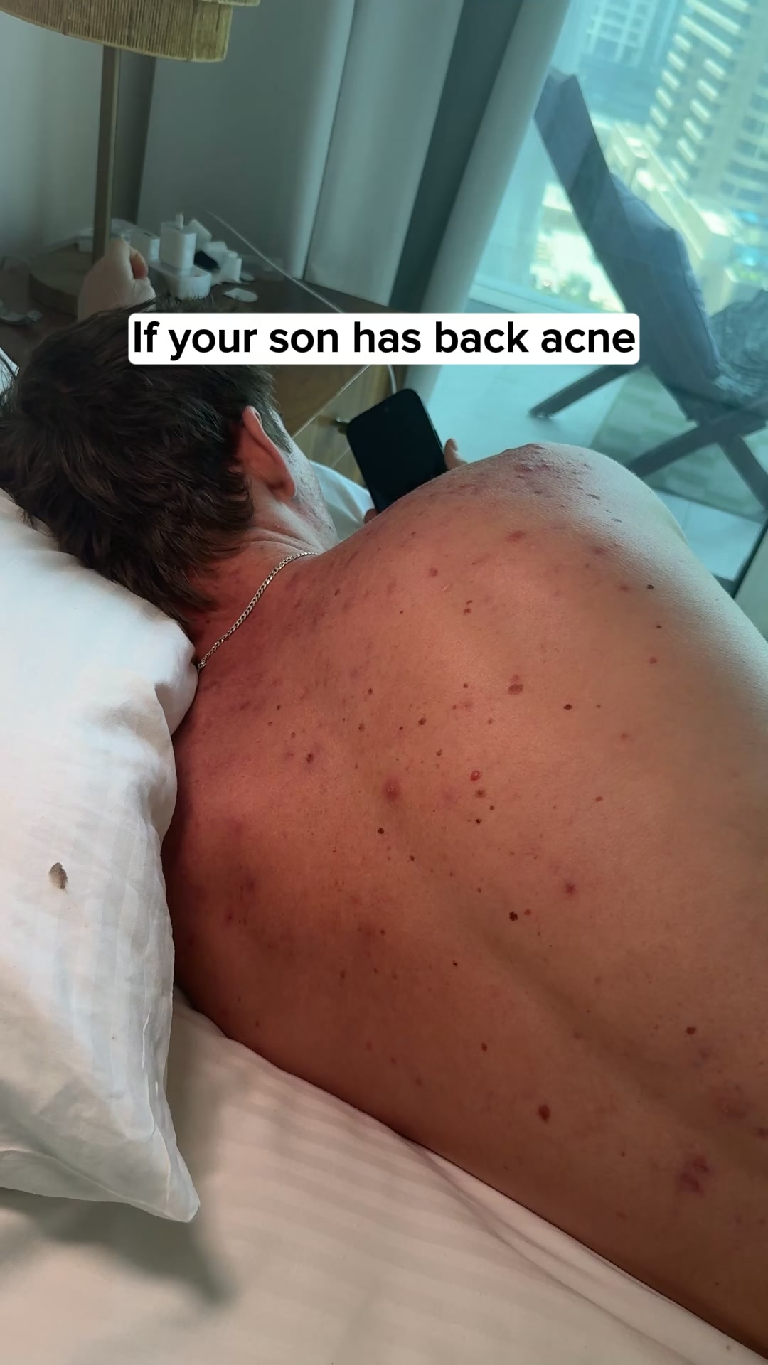 Built for Body and Back Skin.
