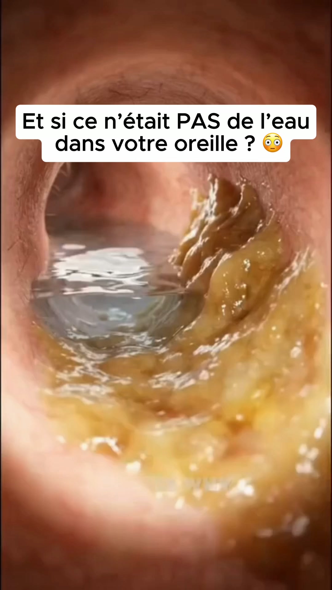 Regardez ce qui ressort