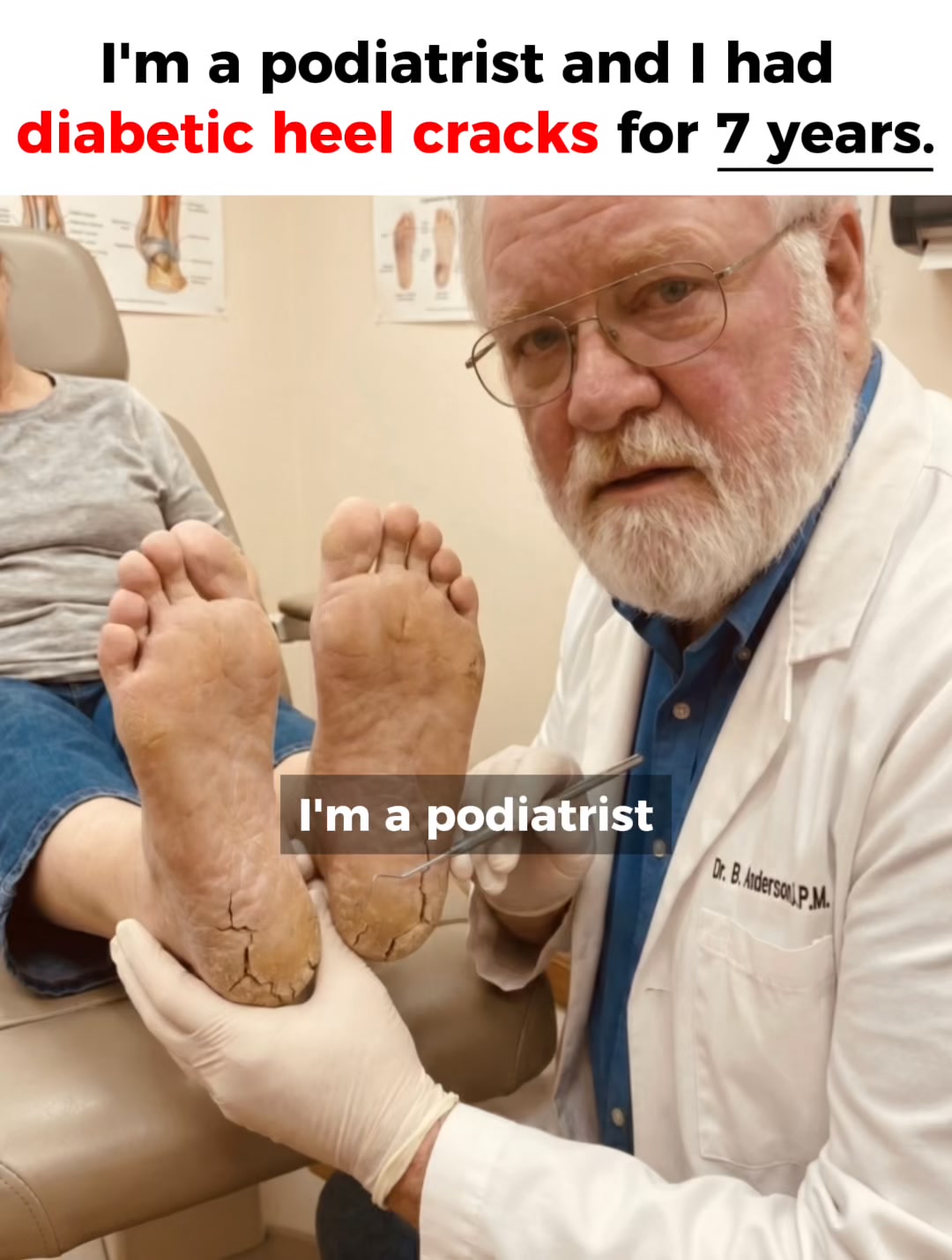 Diabetic heel cracks? Vaseline won’t fix this…