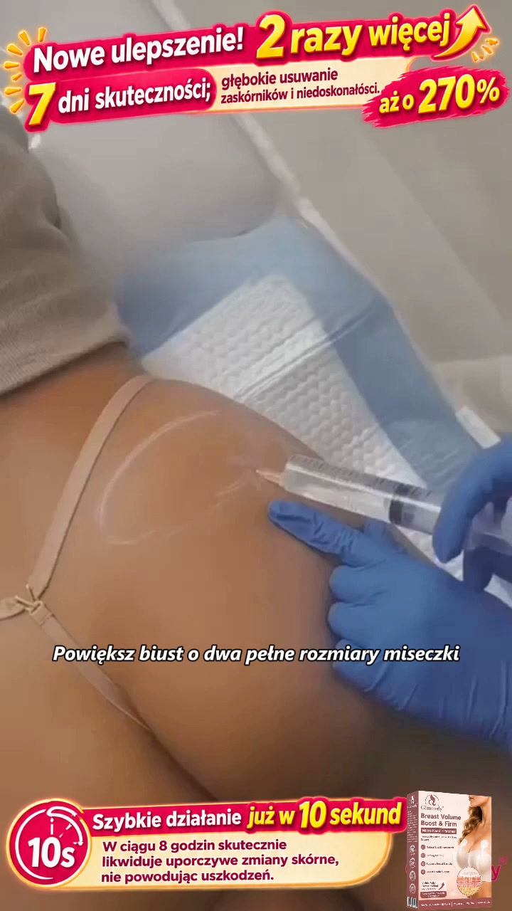 Anúncio de Kzbdgfm