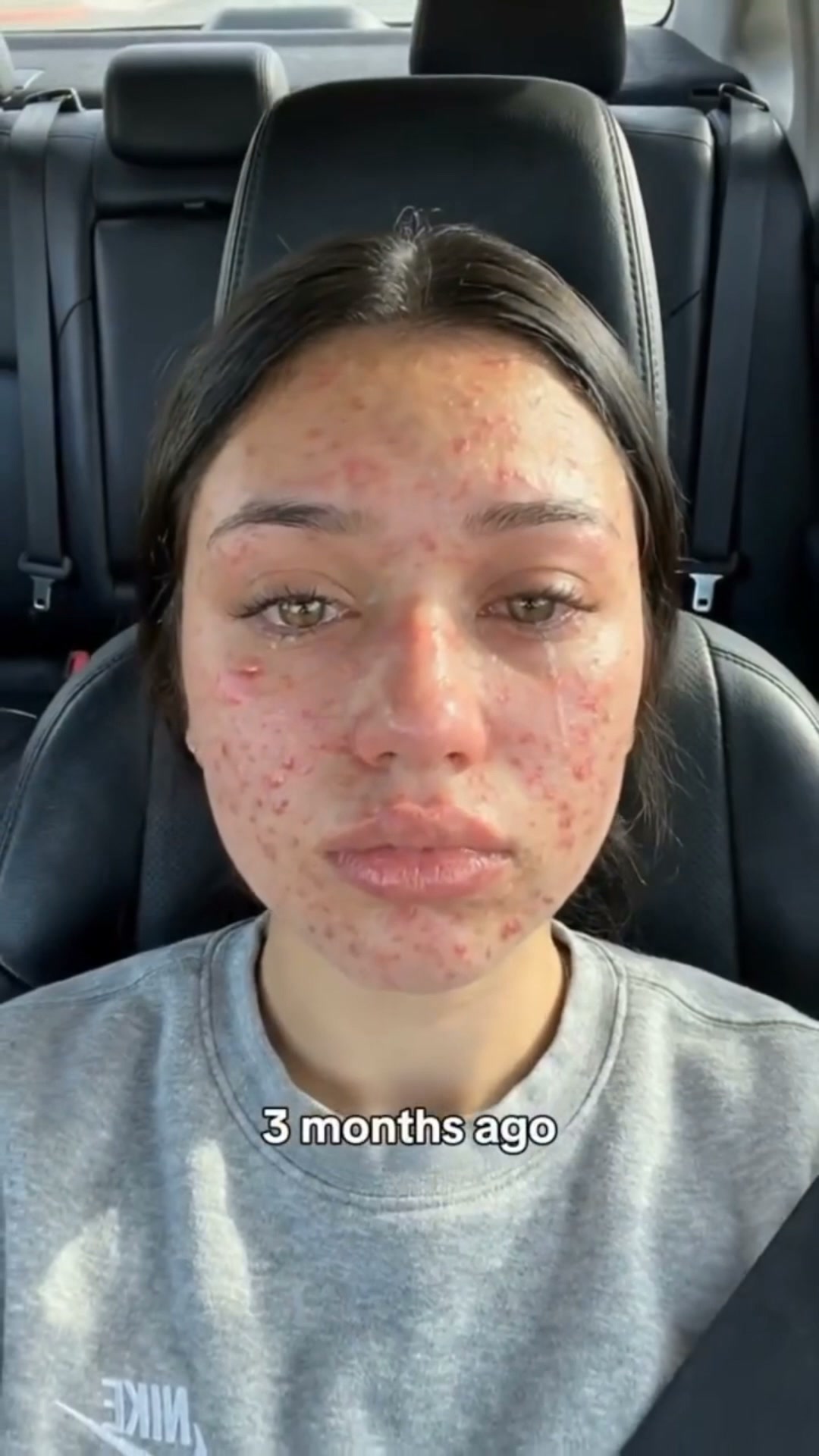 Dark Spots’ Worst Enemy — Meet Your New Glow Serum!