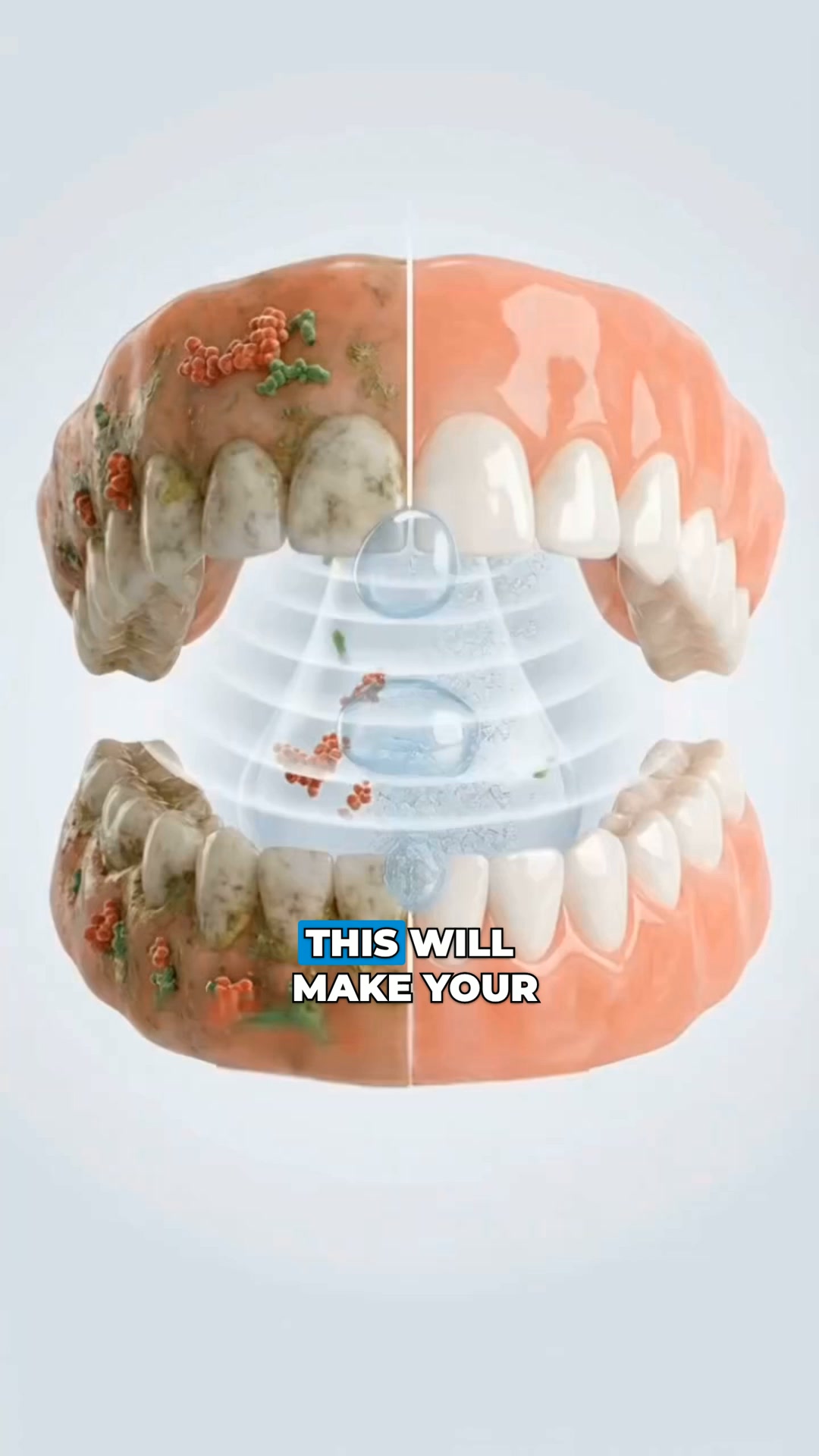 Get a Like-New Denture (In Just 5 Min) Get $30 OFF + Free Shipping