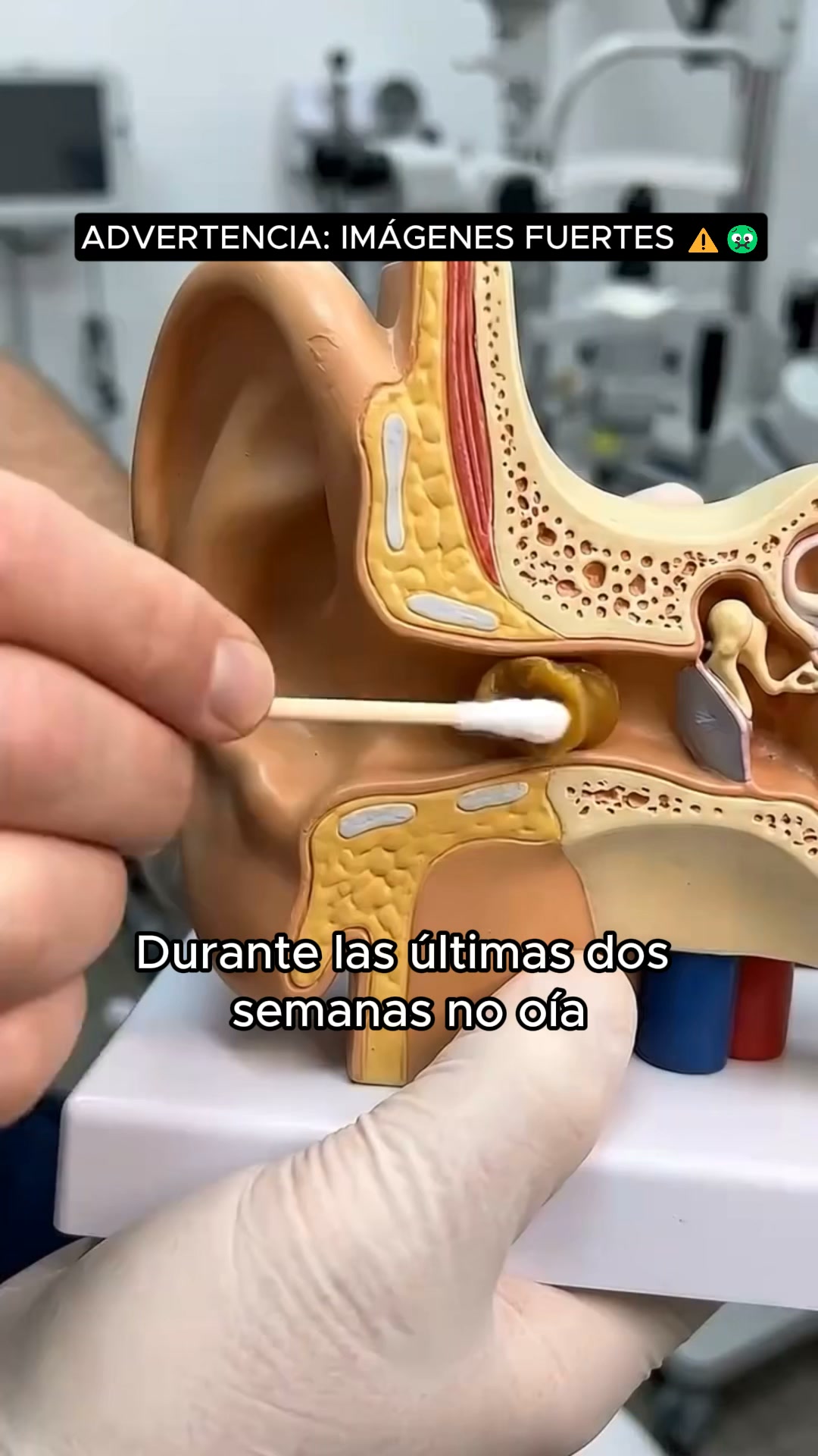 Deja de empujar el cerumen hacia dentro