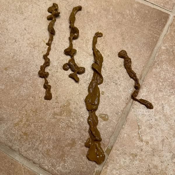 The Thick Gray Coating That Seals Parasites To Your Gut Wall.