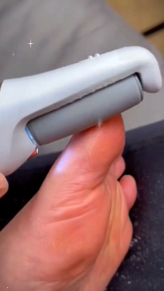 2025’s Most Popular Foot Smoother