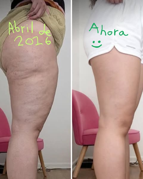 POR FIN PUEDO PONERME MI BAÑADOR FAVORITO