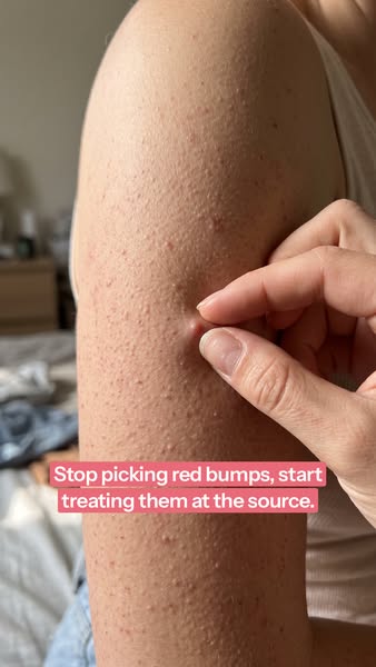 Smoother skin in as little as 14 days