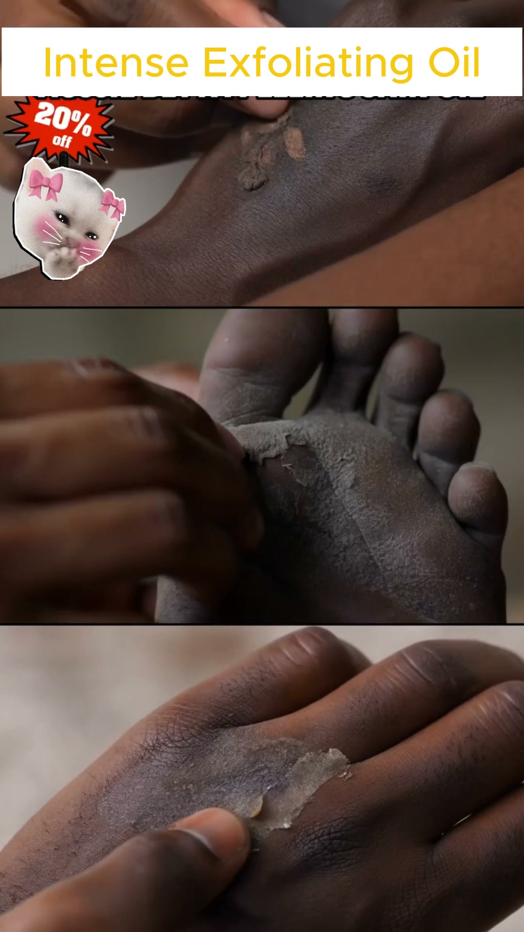 Are you tired of dealing with rough, dry and cracked skin on your hands?