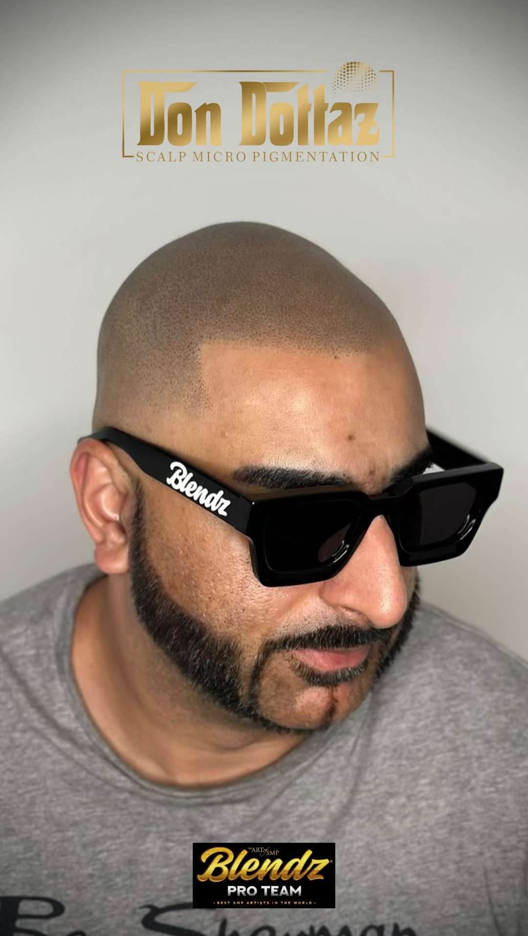 Anúncio de DonDottaz
