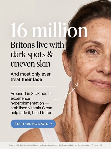 Why Sun Spots Hit the Hands First