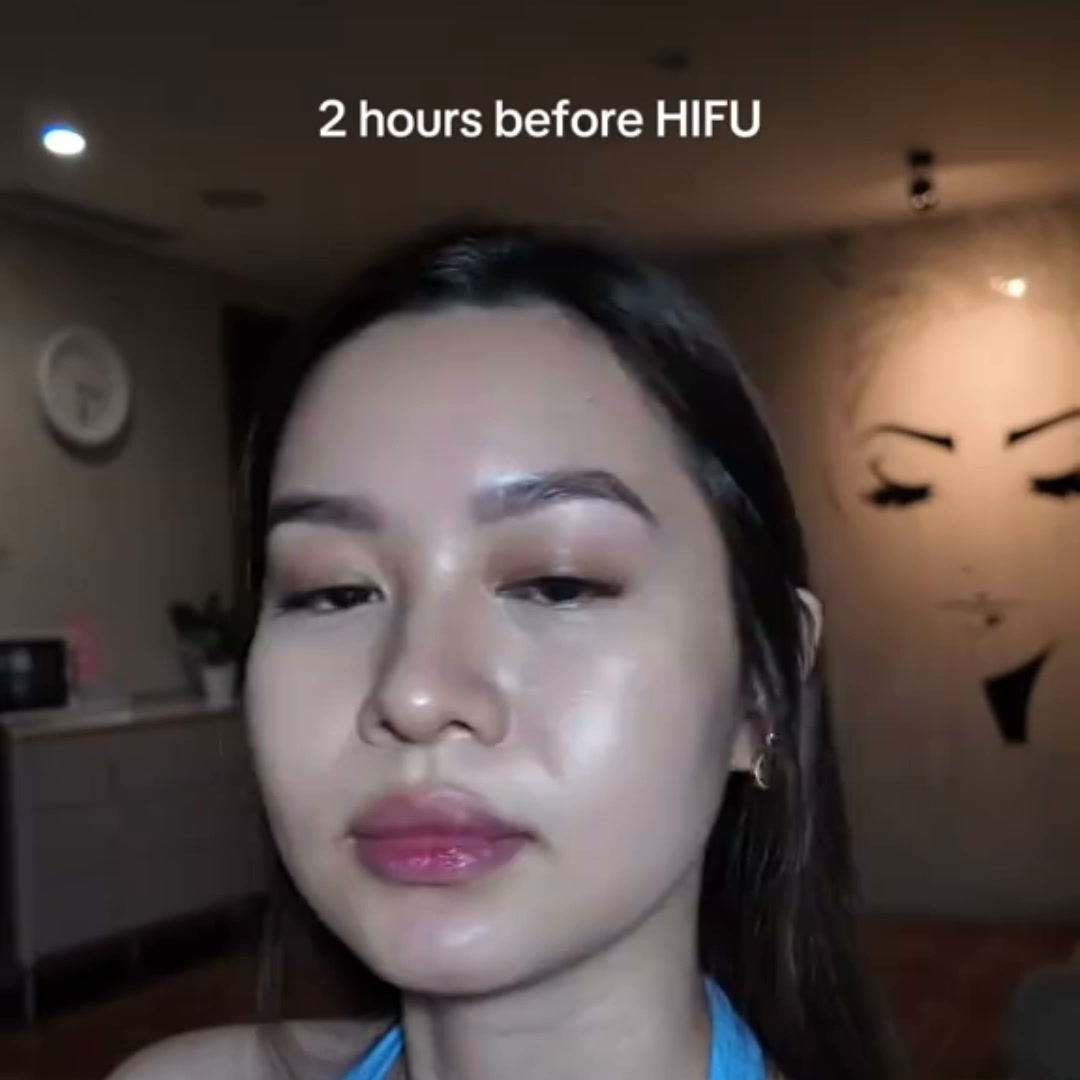 Aprende HIFU 360° Desde Cero