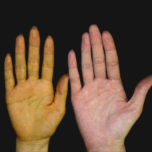 Non dare la colpa al tuo stile di vita - Inizia rimettendo in funzione il tuo fegato