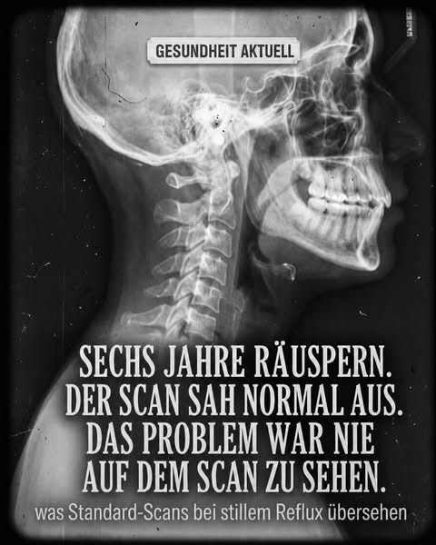 Kein Sodbrennen. Nur ein Husten, den sich niemand erklären kann. Bis jetzt.