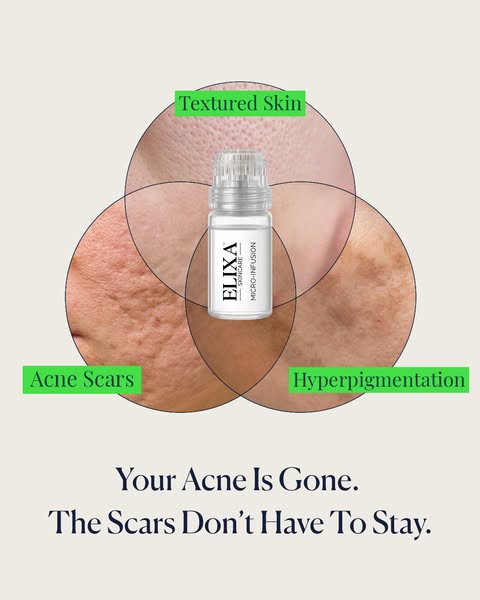 Salmon DNA Heals Acne Scars