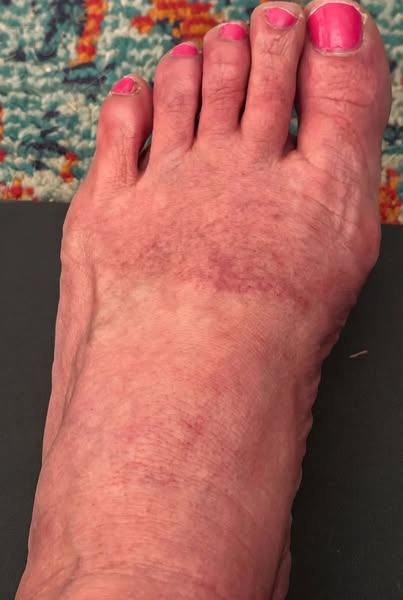 How I discovered my 'permanent' nerve damage wasn't permanent…