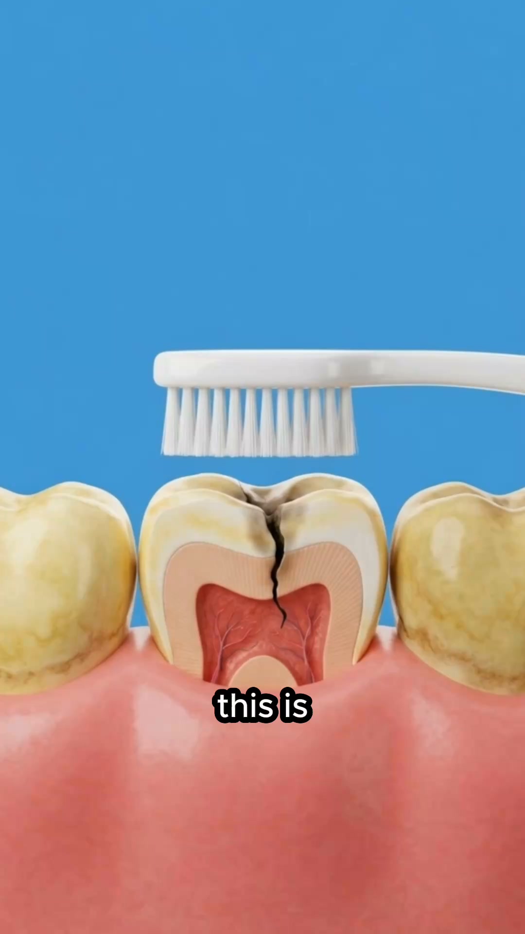 Whiter Teeth Now