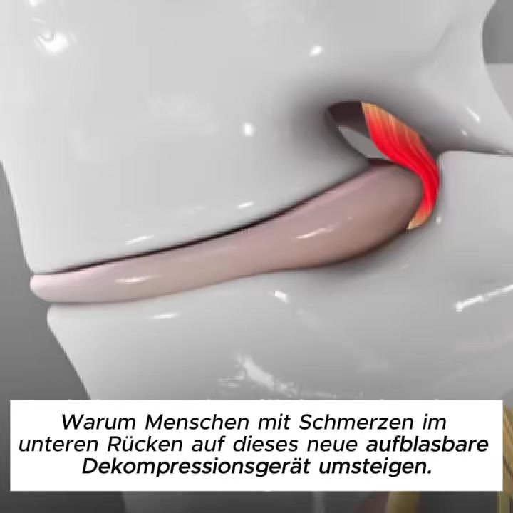5-Minuten-Kur für degenerative Bandscheiben