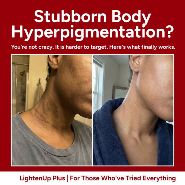 Dark Spots Don't Have To Be Forever