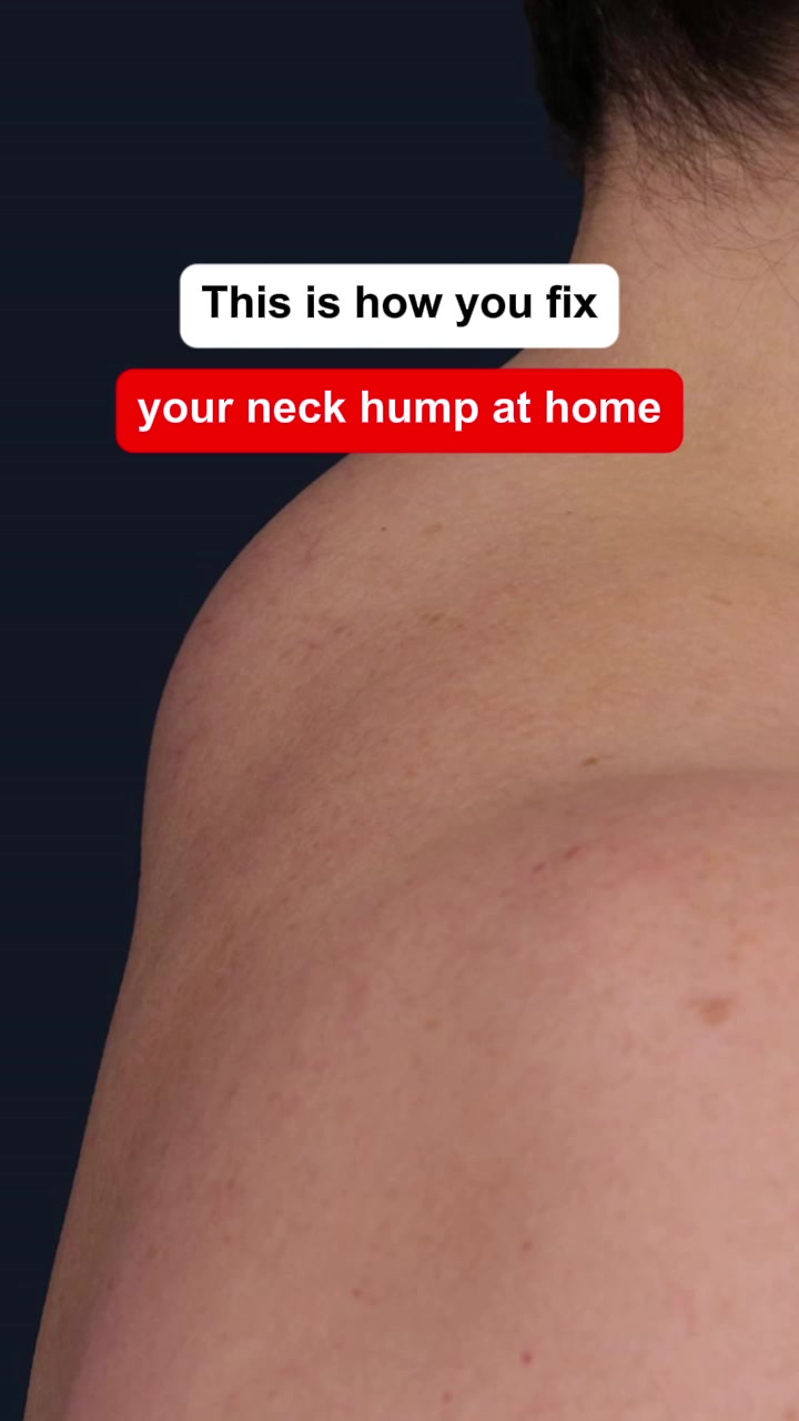 Break Free From Neck Pain & Poor Posture