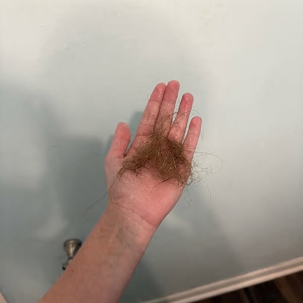Still Losing Hair on Thyroid Meds? Read This.