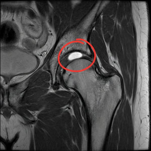 If you’re struggling with joint pain, this is how I...