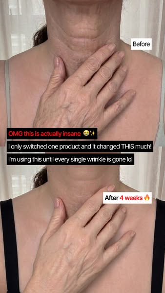 The Neck Serum Everyone Wants