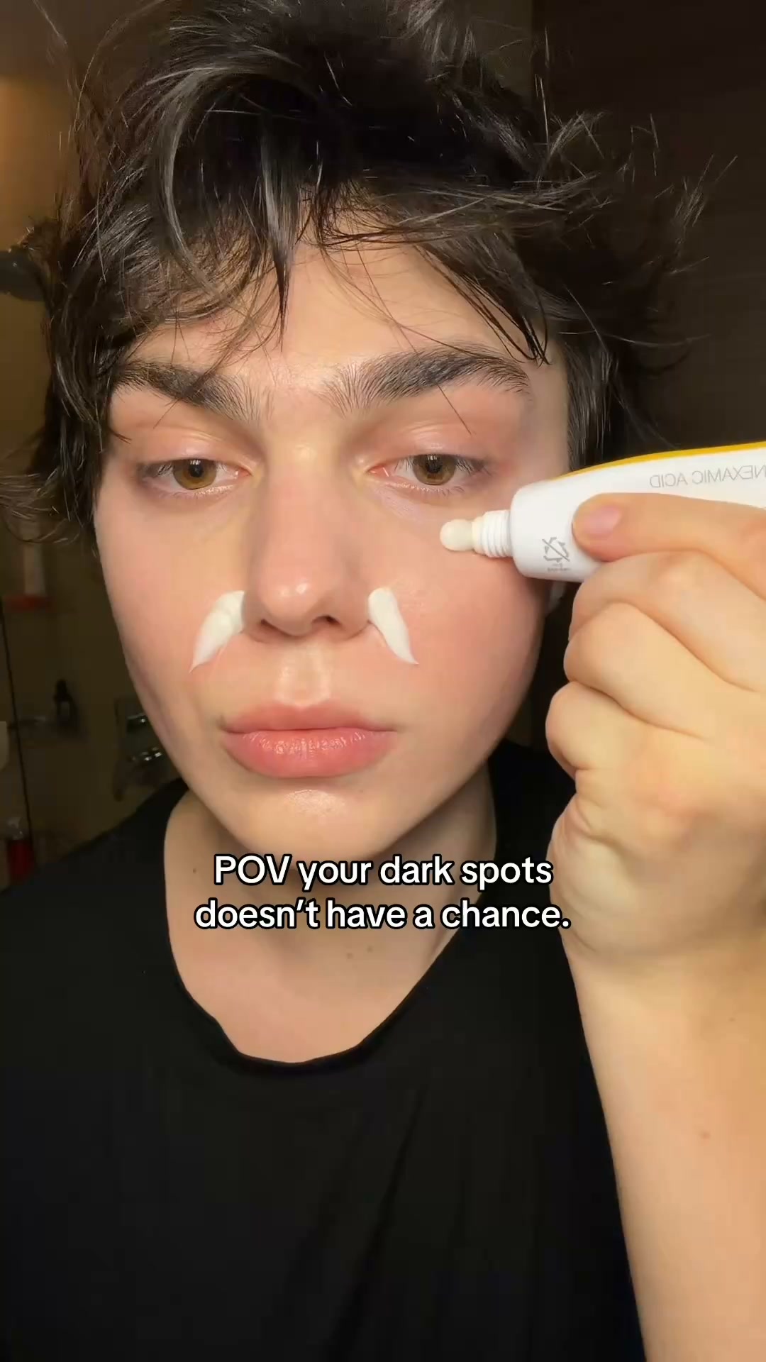 Dark Spots Gone In 2 Weeks