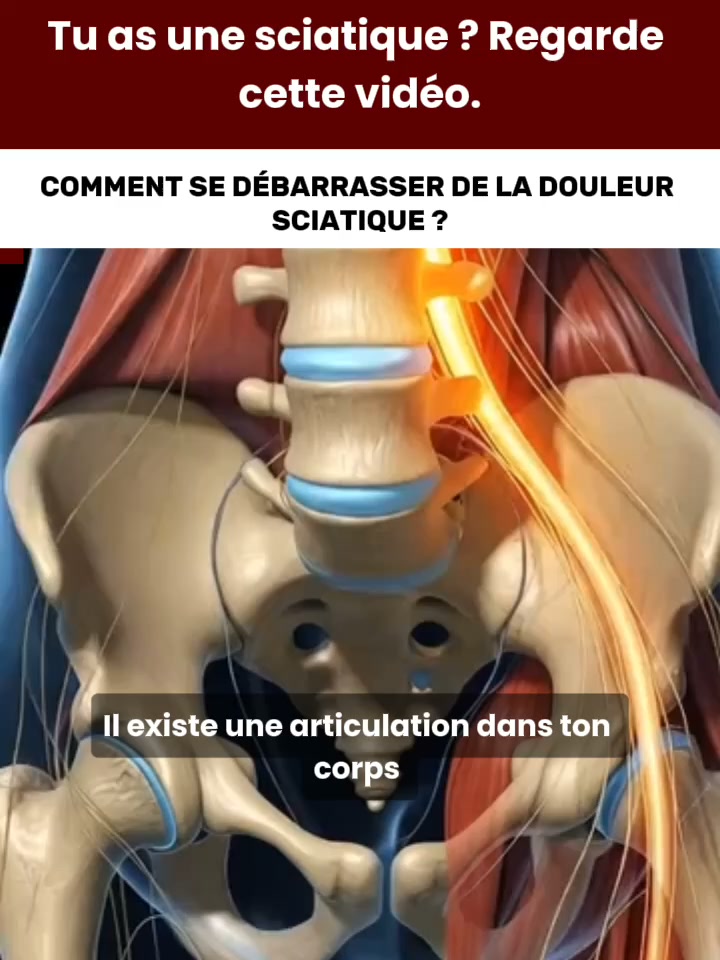 Douleurs lombaires ou sciatique ?