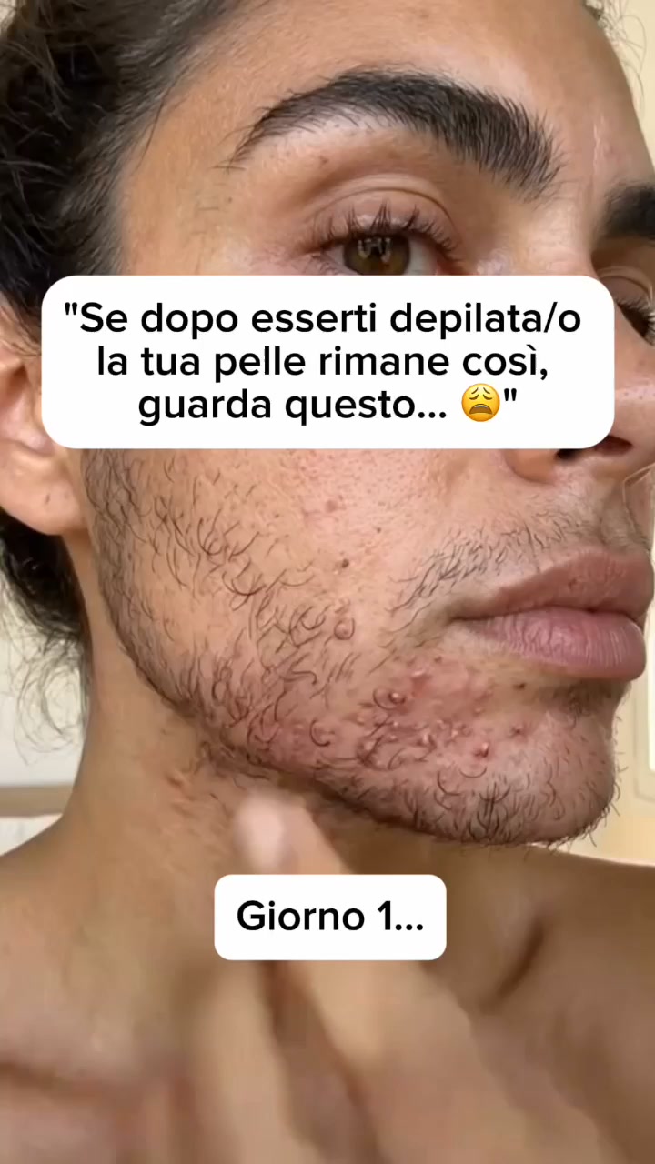 Addio peli sul viso