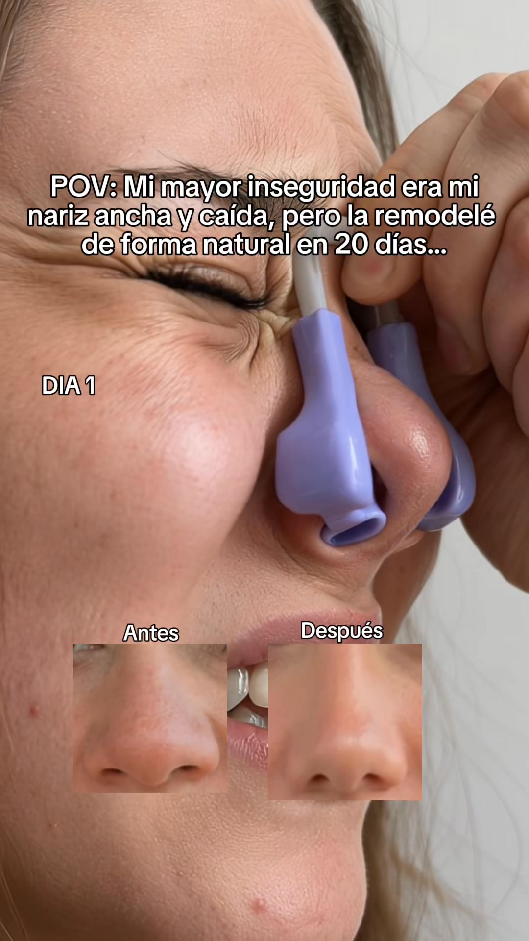 50% De Descuento - ¡Últimas 17/100 Unidades!