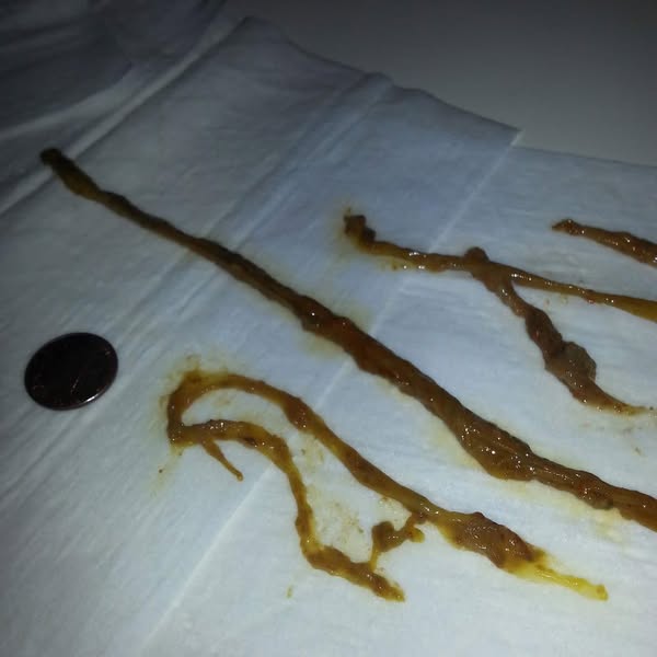 Oregano oil + Black Seed oil