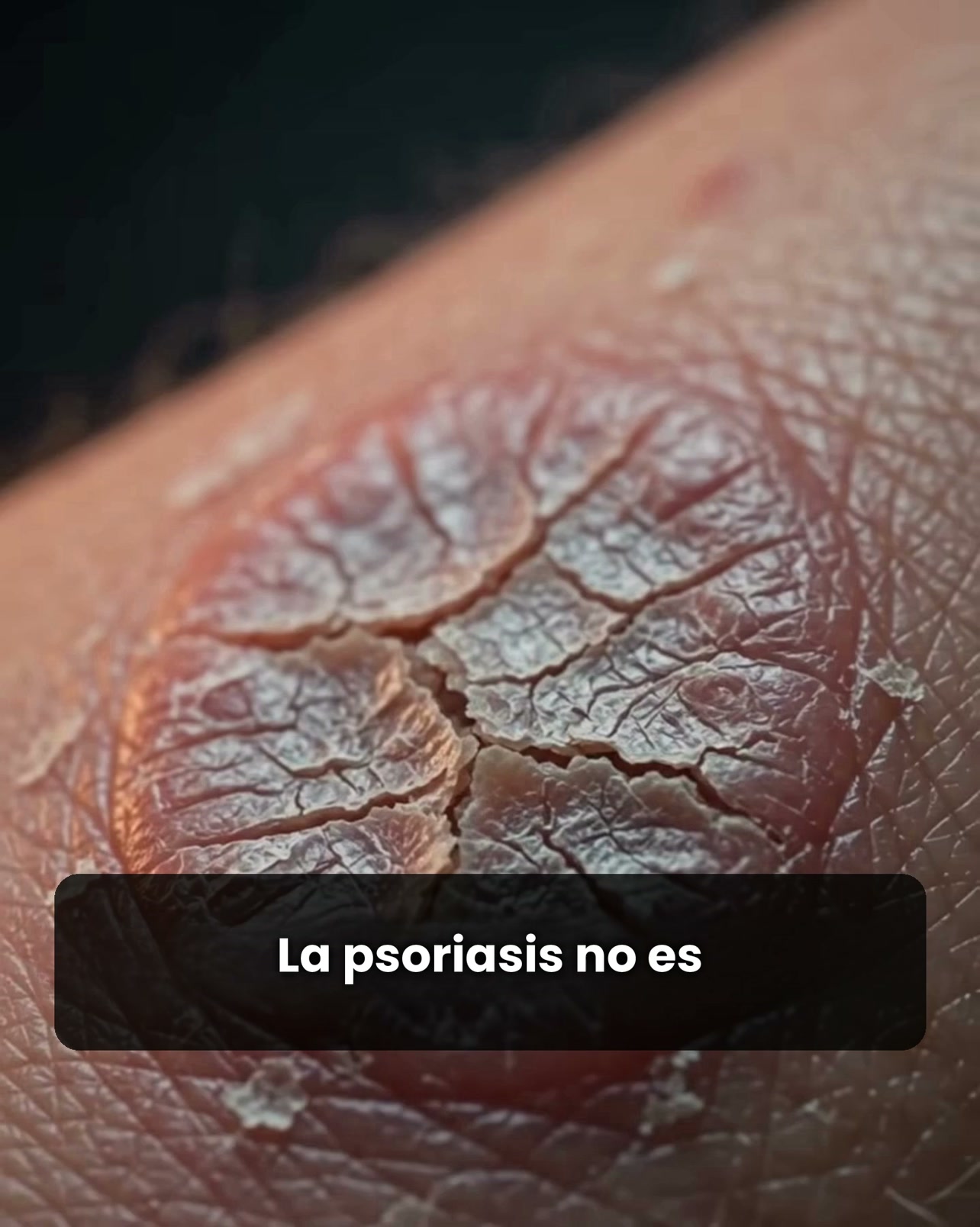 Anúncio de Mendly