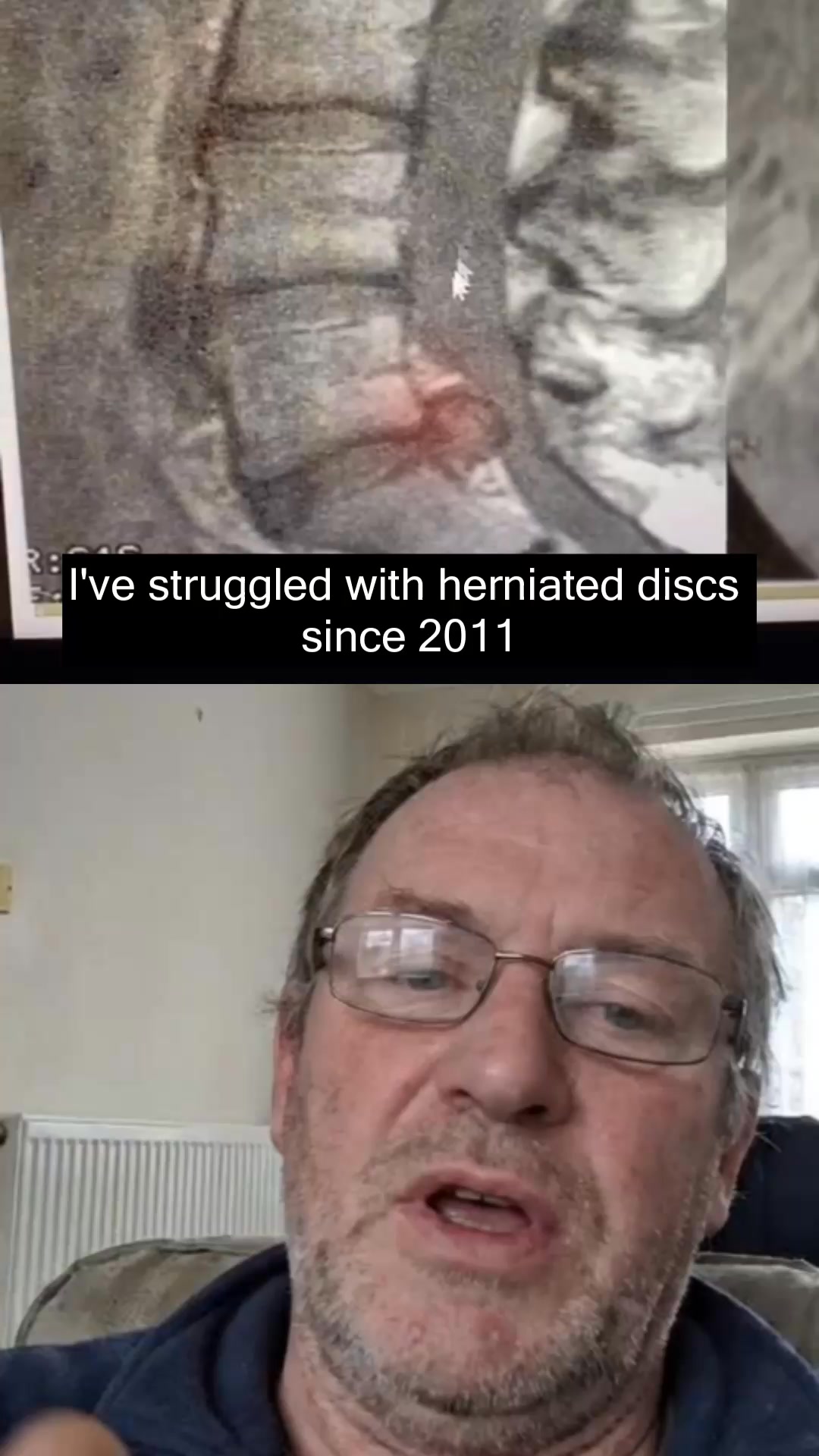Mark’s story