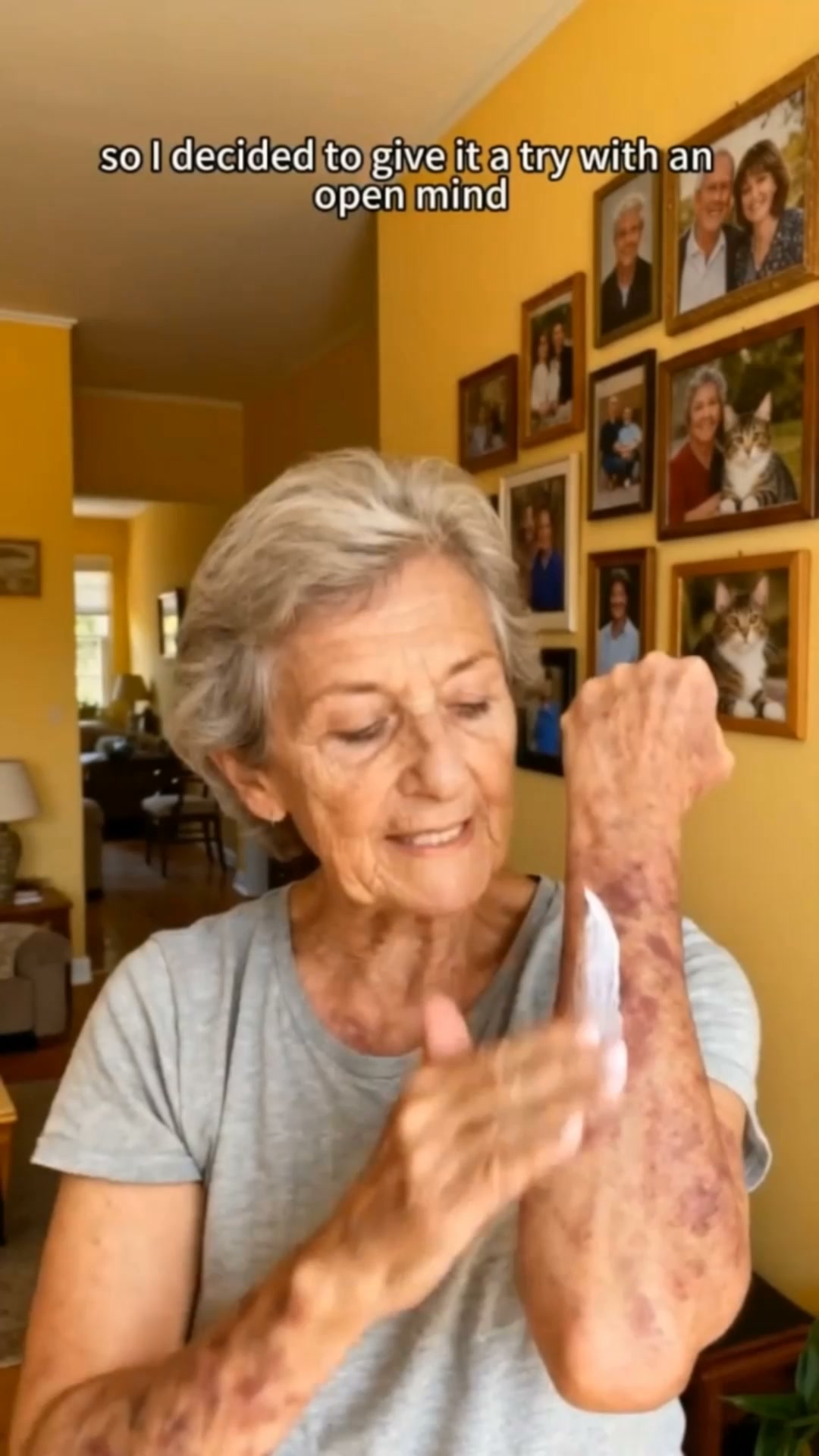 “What Happened to Your Arms?” — Again?!