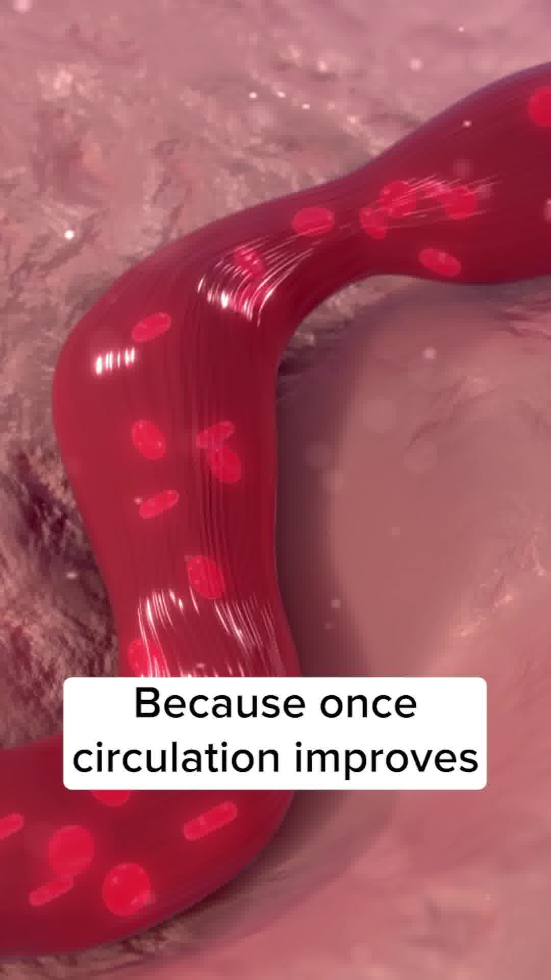 The Natural Choice For Varicose Veins
