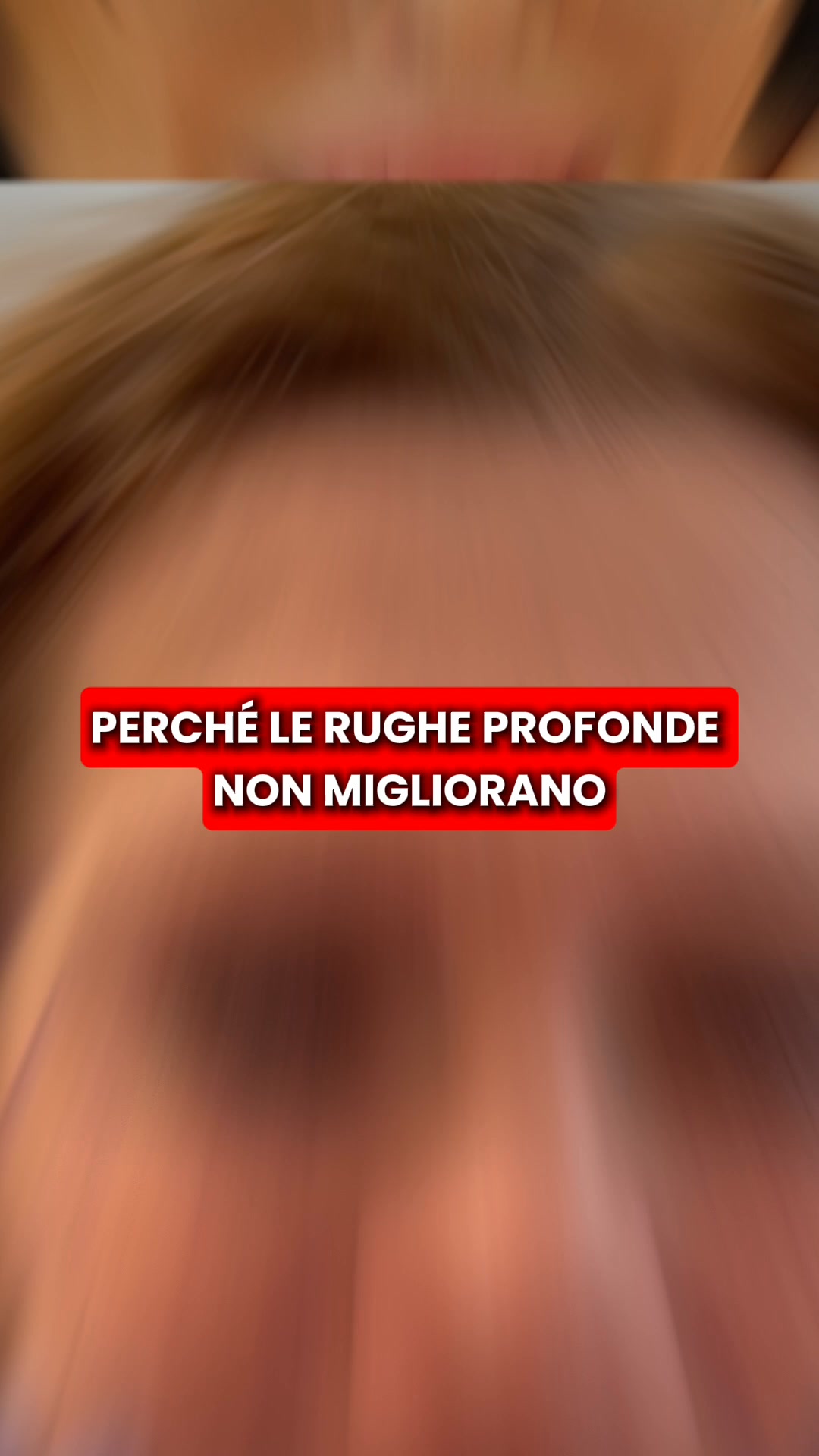 Scopri kit di micro-infusione di Renovae