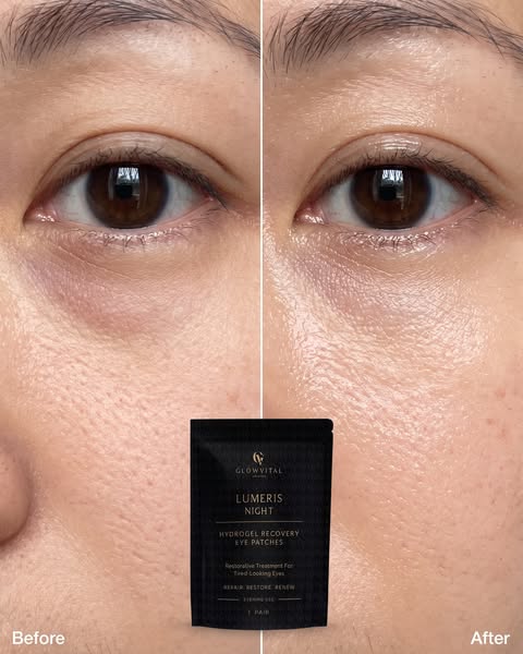 Before and after · Lumeris Night